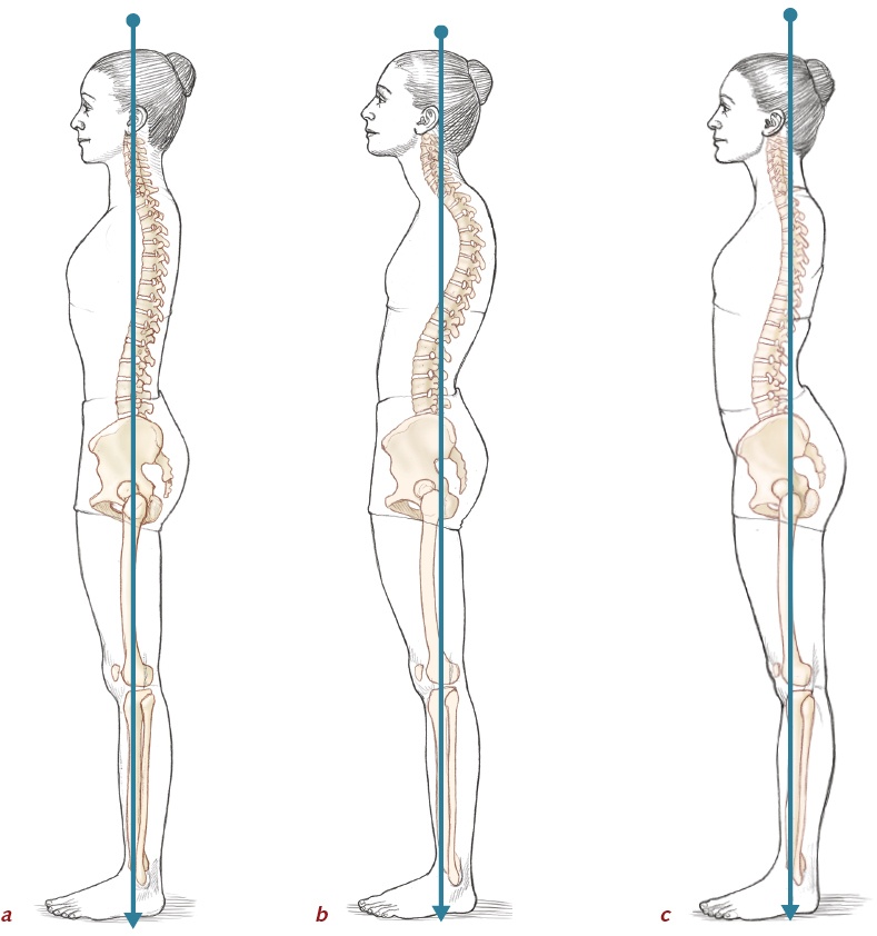 Postural Improvements