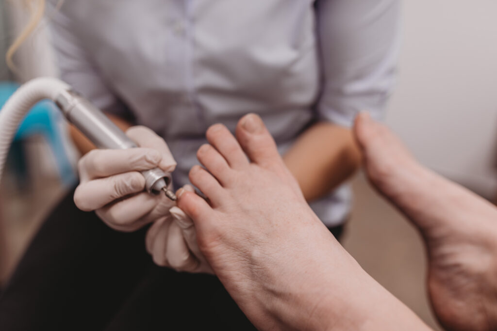 Podiatrist treating patient - general nail care